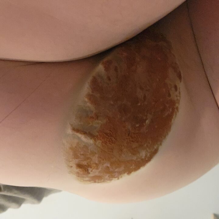 pantyhosefullofpoop