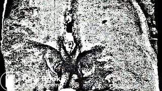 Scatmother - Beltbuckle Discipline ("Purulent Sublimity" Full-Length)