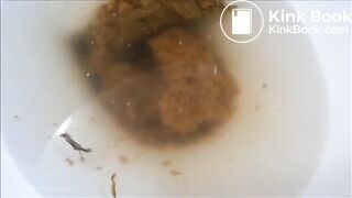 frontal view poop