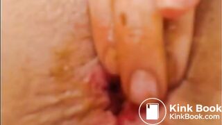 Scat 7