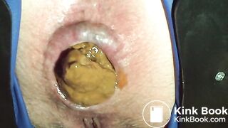 Poo after anal fuck