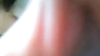 Anal prolapse on live webcam - Dirtyshack Free Scat Tube Vid