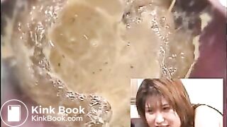 Japanese constipation treatment