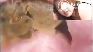 Japanese constipation treatment