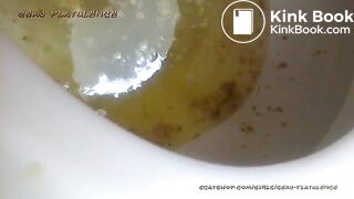 diarrhea-show