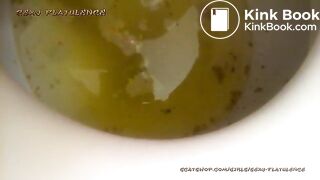 diarrhea-show