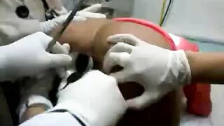 Buttplug extraction