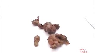 The brown side of life 55