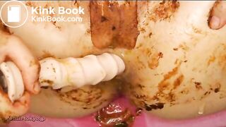 Jap Prolapse Scatplay