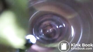 Observation　Inside Anus