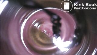 Observation　Inside Anus