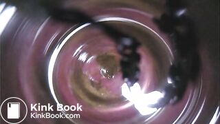 Observation　Inside Anus