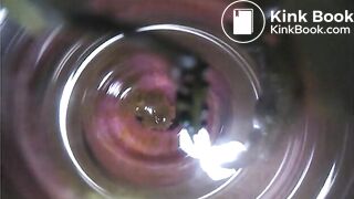 Observation　Inside Anus