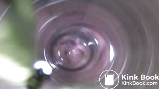 Observation　Inside Anus