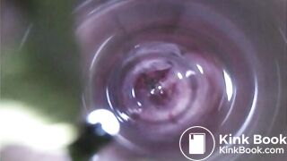 Observation　Inside Anus