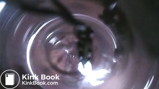 Observation　Inside Anus