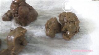 Huge compacted turds stretch her anus wide