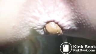 Outdoor women shitting - Pooping and pissing girls PooPeeGir