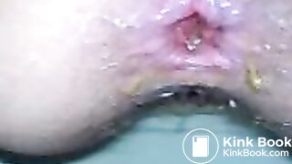 MOV00002_poop_shitting