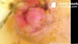 Anal Rosebud Poop Stuffing