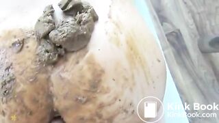 Anal Scat