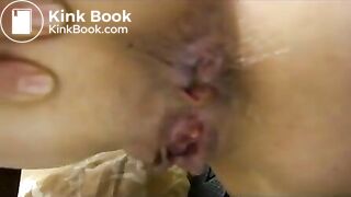 Russian Woman Pooping Beside Her Friend