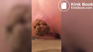 Really hard poop