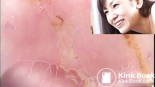 The brown side of life 774