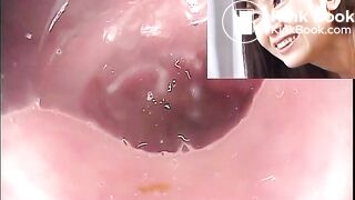 The brown side of life 774