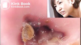 The brown side of life 774