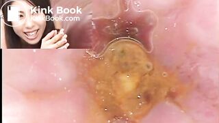 The brown side of life 637