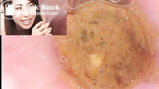 The brown side of life 637