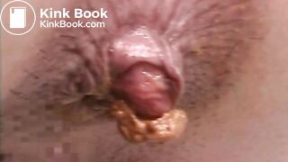 The brown side of life 754