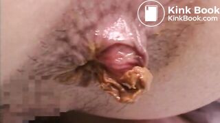 The brown side of life 754