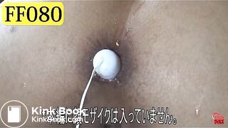 The brown side of life 408