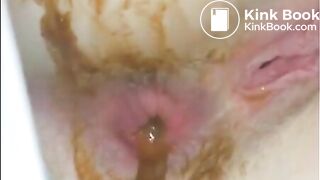 The brown side of life 1062