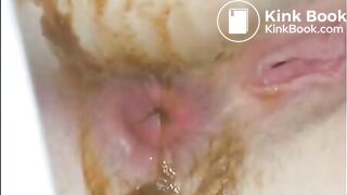 The brown side of life 1062