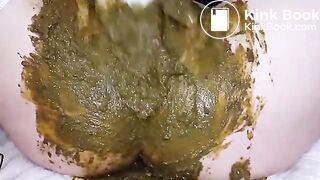 SpeculumFilledPussyPart2