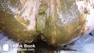 SpeculumFilledPussyPart2