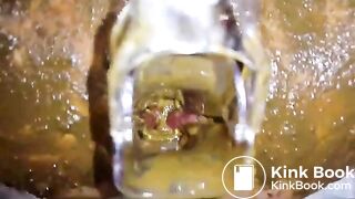 SpeculumFilledPussyPart2