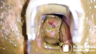 SpeculumFilledPussyPart2