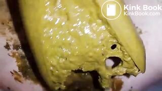 SpeculumFilledPussyPart2