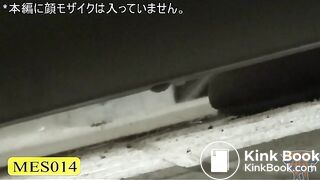 The brown side of life 416