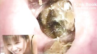 The brown side of life 458