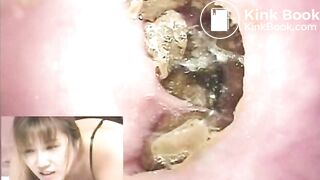 The brown side of life 458