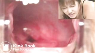 The brown side of life 458