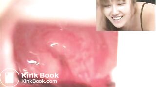 The brown side of life 458