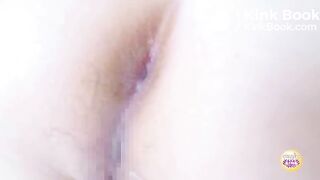 Constipation Clinic 8