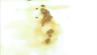 Jap Girl Enema Poop While Masturbating