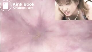 The brown side of life 463